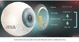 [K렌즈 성장기]③ "꿈의 렌즈 향해"... 인터로조, 기술 혁신 '총력' - 뉴스 썸네일 이미지